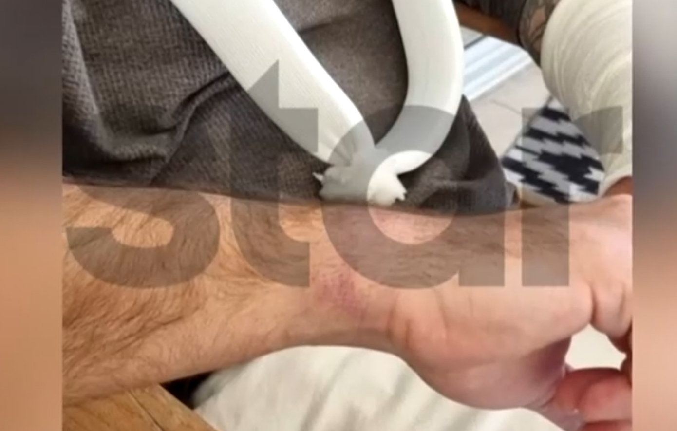 Σοκαριστική καταγγελία για αστυνομική βία: «Με έριξαν κάτω, μου έριχναν μπουνιές και μου έσπασαν το χέρι»