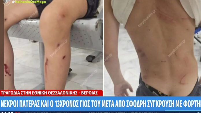Αγέλη αδέσποτων σκυλιών επιτέθηκε και δάγκωσε 7χρονο στον Βόλο