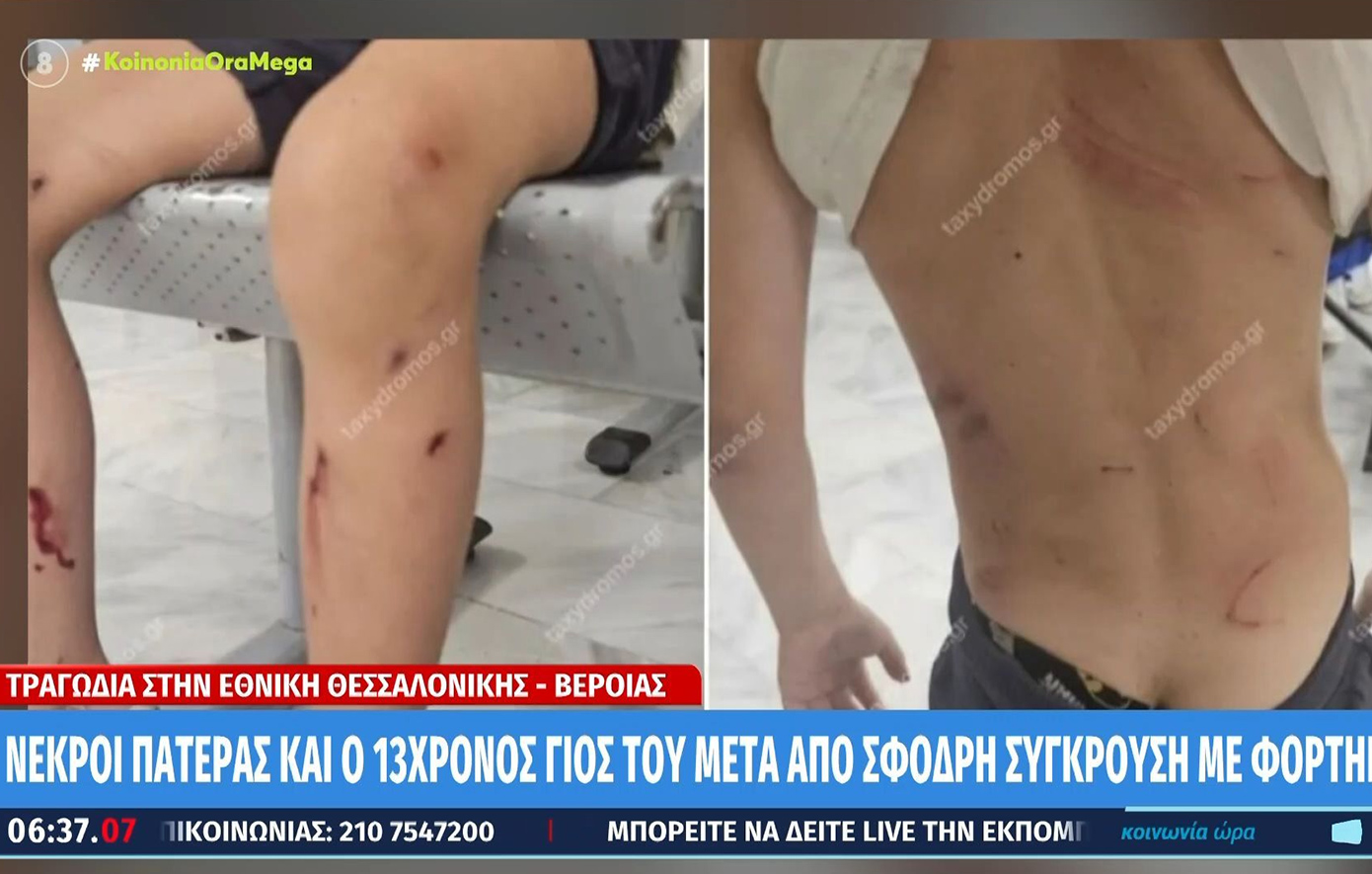 Αγέλη αδέσποτων σκυλιών επιτέθηκε και δάγκωσε 7χρονο στον Βόλο