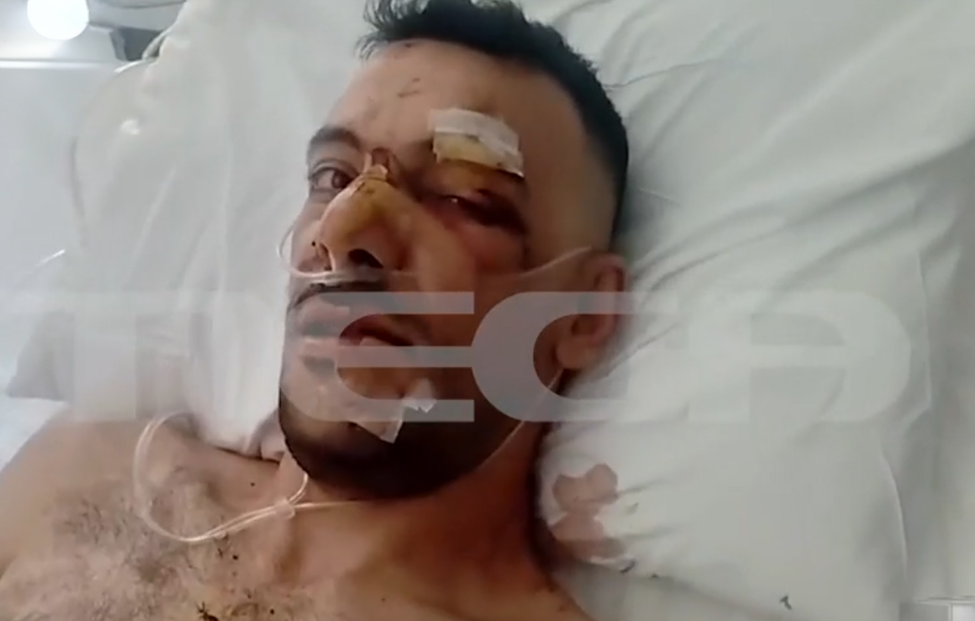 Μυτιλήνη: Προφυλακίστηκε ο 32χρονος για τη μαχαιρωματιά σε 35χρονο κατά τη διάρκεια πανηγυριού