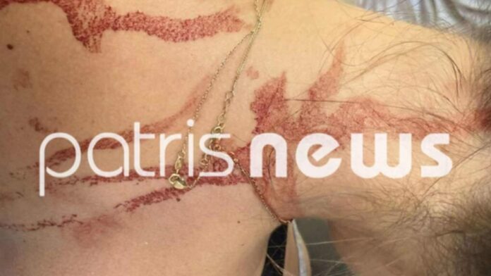 3,65 εκ. ευρώ για την κατασκευή της Περιφερειακής Οδού Αμαλιάδας