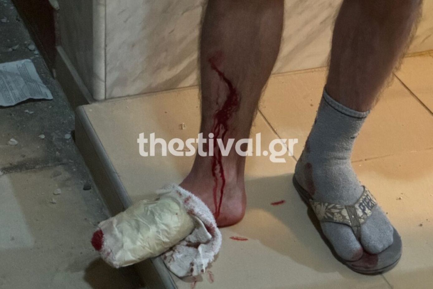 Οι Αρχές υποψιάζονται τρομοκρατική ενέργεια πίσω από την έκρηξη με τους 2 τραυματίες σε πολυκατοικία στη Θεσσαλονίκη