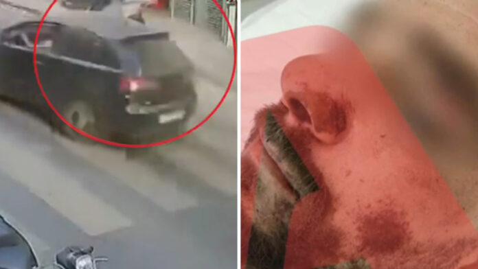 «Σερνόμουν στον δρόμο – Ακόμα και ζώα να ήμασταν, θα σταματούσες»: Συγκλονίζει ο διανομέας που παρέσυρε και εγκατέλειψε 17χρονος στην Κρήτη