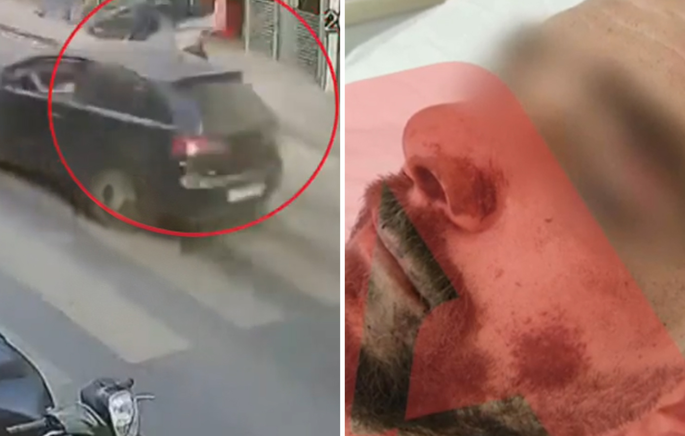 «Σερνόμουν στον δρόμο – Ακόμα και ζώα να ήμασταν, θα σταματούσες»: Συγκλονίζει ο διανομέας που παρέσυρε και εγκατέλειψε 17χρονος στην Κρήτη