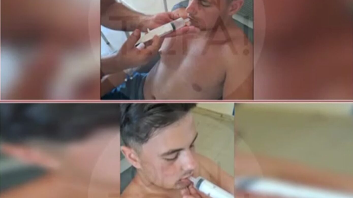 Σοκαριστική επίθεση στη Βόνιτσα: 15 άτομα ξυλοκόπησαν 18χρονο, του έσπασαν σαγόνι και χέρι – Τρέφεται με σύριγγα