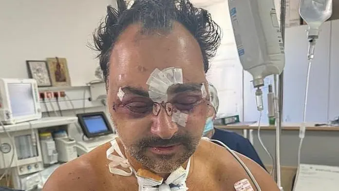 Αποφυλακίστηκαν οι δύο κατηγορούμενοι για τον ξυλοδαρμό του Ελληνοκαναδού στην Κρήτη