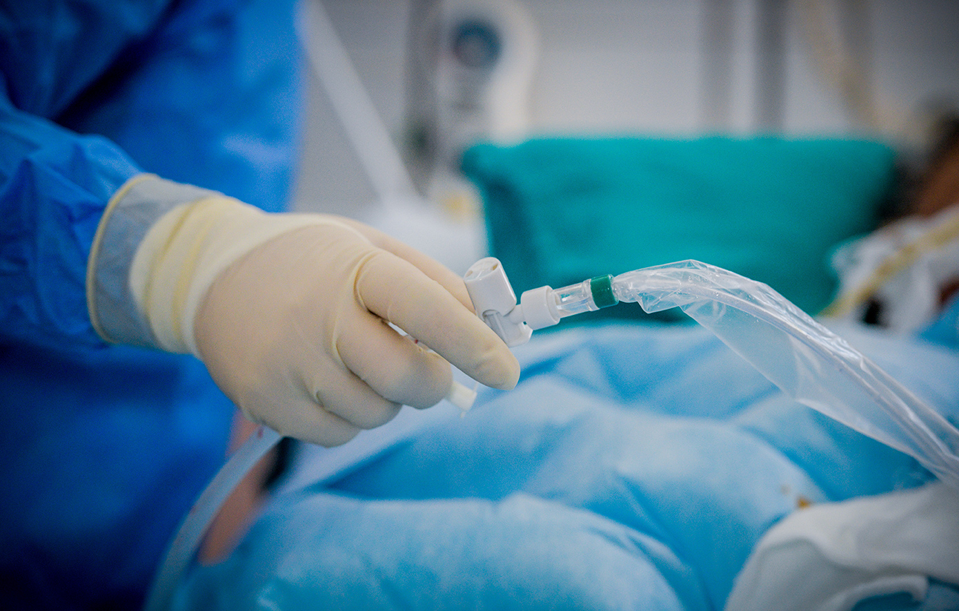 Συναγερμός για τον Candida auris σε έξαρση – «Αύξηση 60% πανευρωπαϊκά» – Ανησυχούν οι ειδικοί