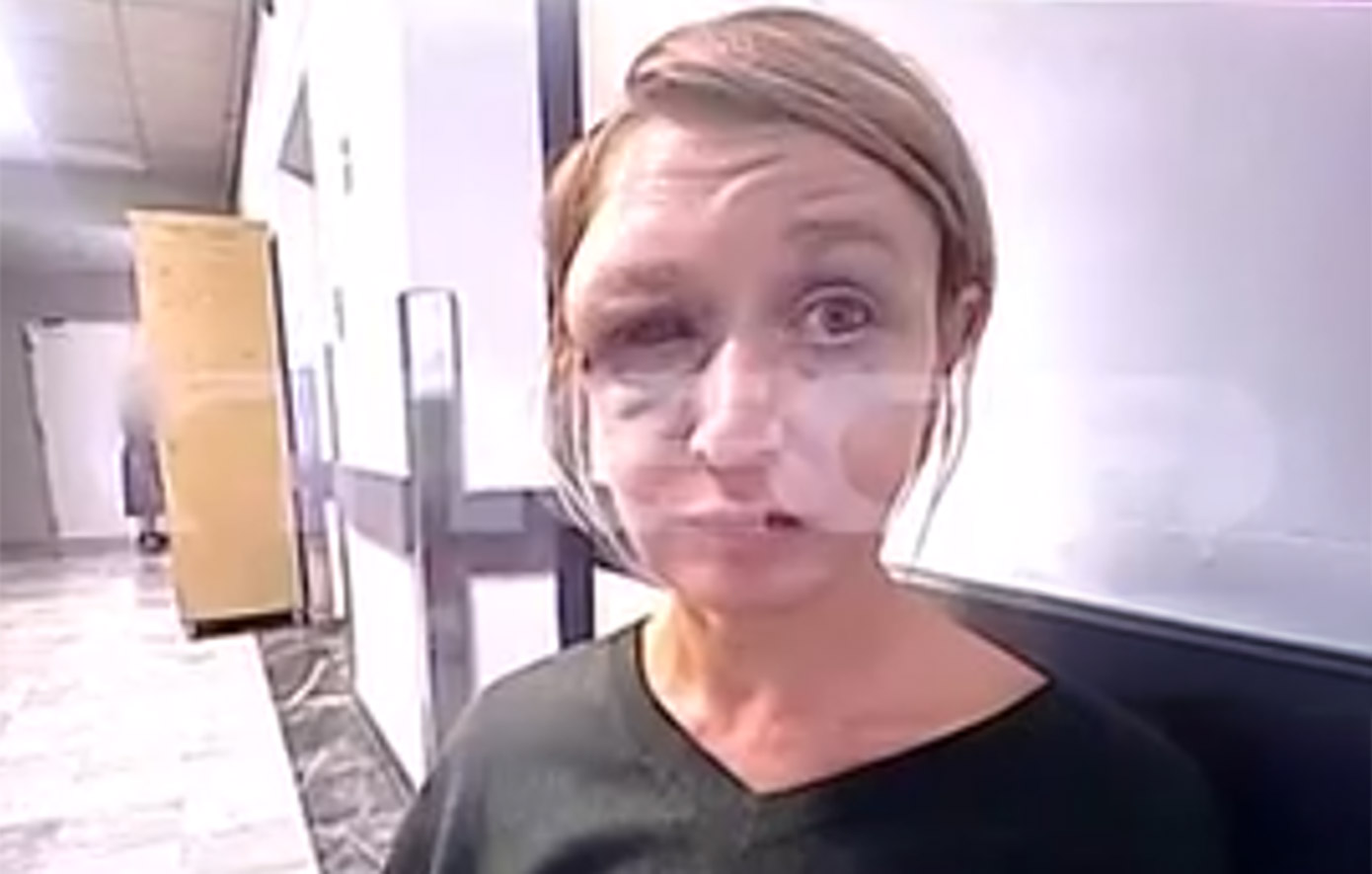 Συγκλονίζει η εικόνα της 40χρονης στο Κορωπί μετά την κακοποίησή της – «Τον αγαπώ, είμαστε μια φυσιολογική οικογένεια»