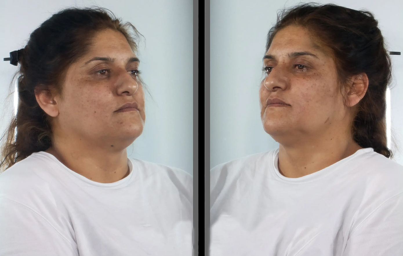 Αγκάλιαζε κόσμο στον δρόμο και τους έκλεβε τις χρυσές αλυσίδες από τον λαιμό τους – Στη δημοσιότητα τα στοιχεία 37χρονης