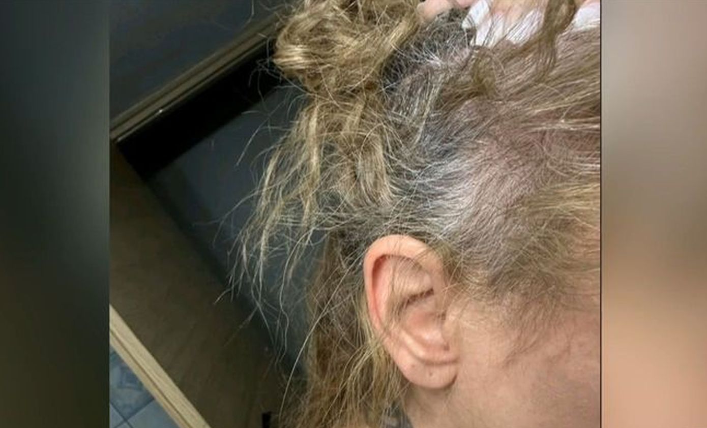 «Χτύπησε το κεφάλι της στο τιμόνι»: Σήμερα η δίκη του πλαστικού χειρουργού για τον ξυλοδαρμό της 42χρονης οδηγού