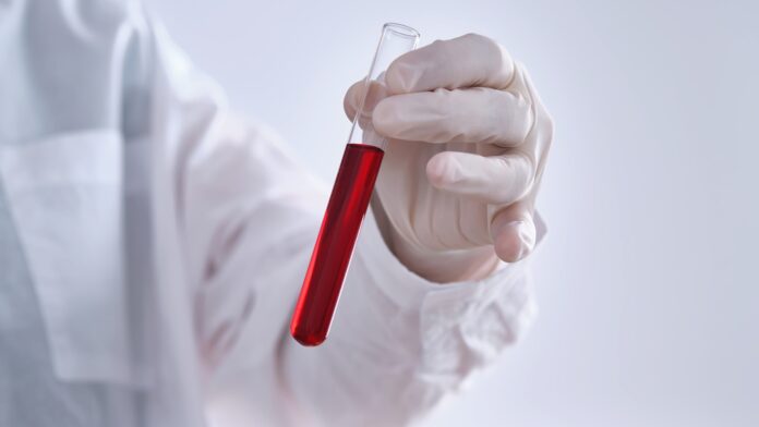 Το «χρυσό αίμα»: Ο εξαιρετικά σπάνιος τύπος που διαθέτουν λιγότεροι από 50 άνθρωποι παγκοσμίως