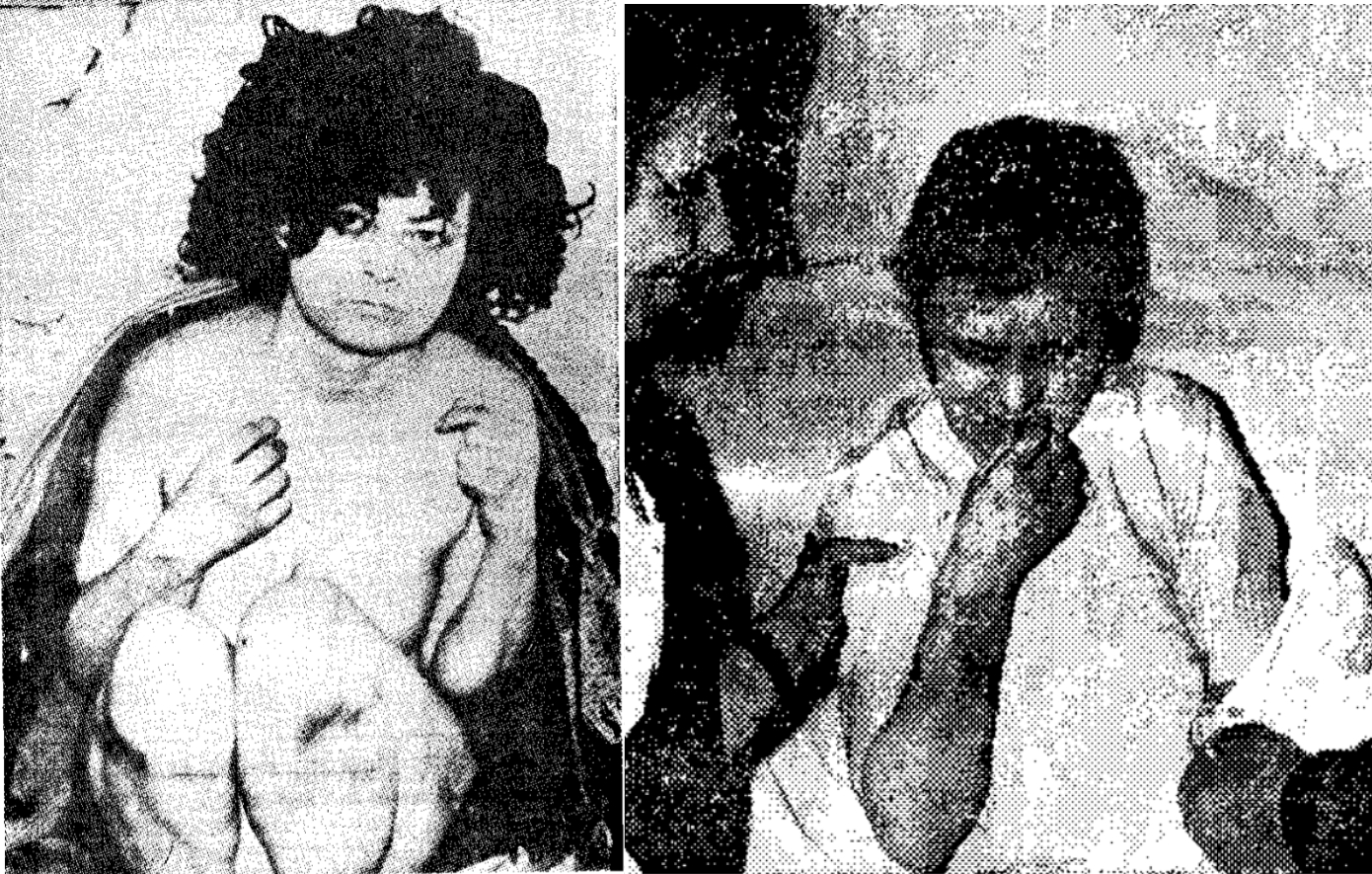 Σαν σήμερα 7 Νοεμβρίου: Η γυναίκα που ξαναβρήκε το φως του ήλιου μετά από 29 χρόνια εγκλεισμού – Η σιωπή ενός ολόκληρου χωριού