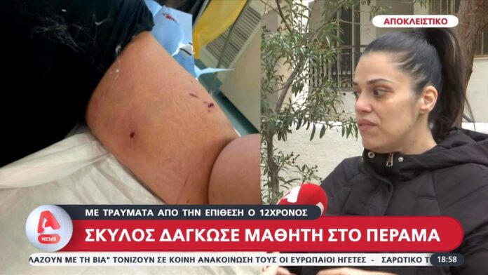 Σκύλος επιτέθηκε σε 12χρονο κοντά σε σχολείο στο Πέραμα – Τι ανέφερε η μητέρα για τον ιδιοκτήτη;