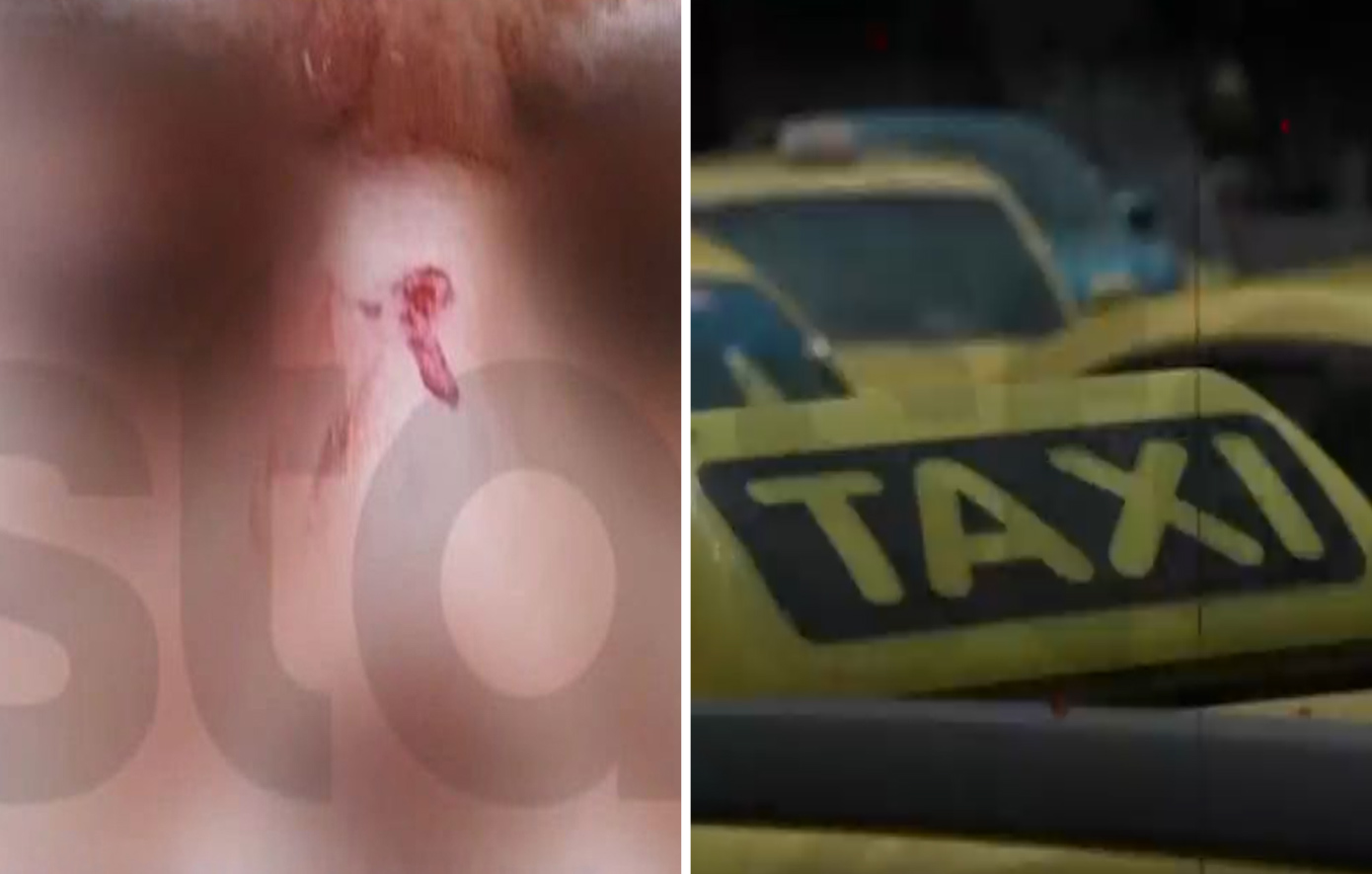 Βίαιη επίθεση σε οδηγό ταξί στον Πειραιά από επιβάτη – Καταιγισμός χτυπημάτων στο πρόσωπο, επειδή δεν ήταν διαθέσιμος