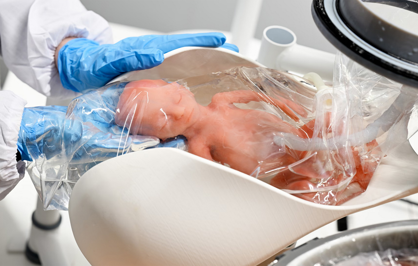 Βελτιώνεται τεχνητή μήτρα που μπορεί να διατηρήσει ζωντανό ένα μωρό – Δυστοπία ή ελπίδα για την ανθρωπότητα