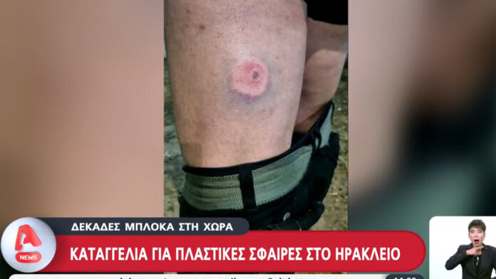 Αγρότες καταγγέλλουν ότι χτυπήθηκαν με πλαστικές σφαίρες από αστυνομικούς – Τι απαντά η ΕΛ.ΑΣ.