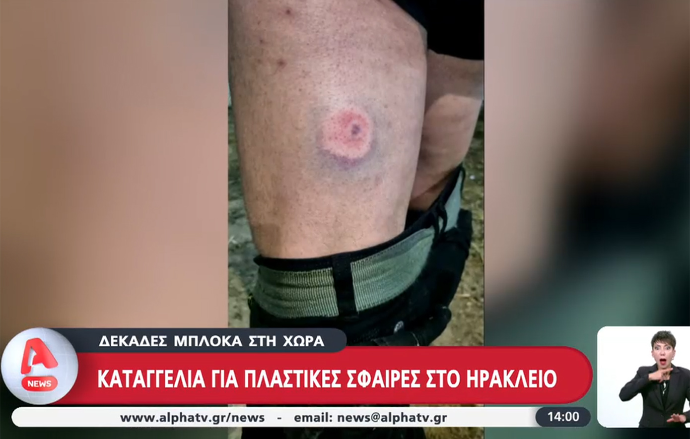 Αγρότες καταγγέλλουν ότι χτυπήθηκαν με πλαστικές σφαίρες από αστυνομικούς – Τι απαντά η ΕΛ.ΑΣ.