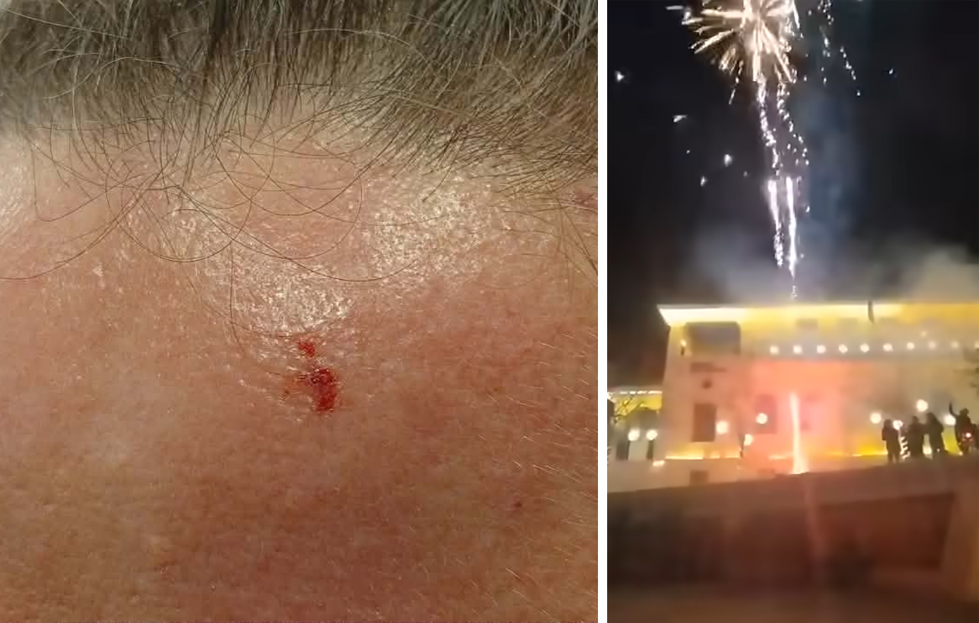 Αναστάτωση σε χριστουγεννιάτικη εκδήλωση στην Κοζάνη – Φόβος και τραυματισμοί από πυροτεχνήματα