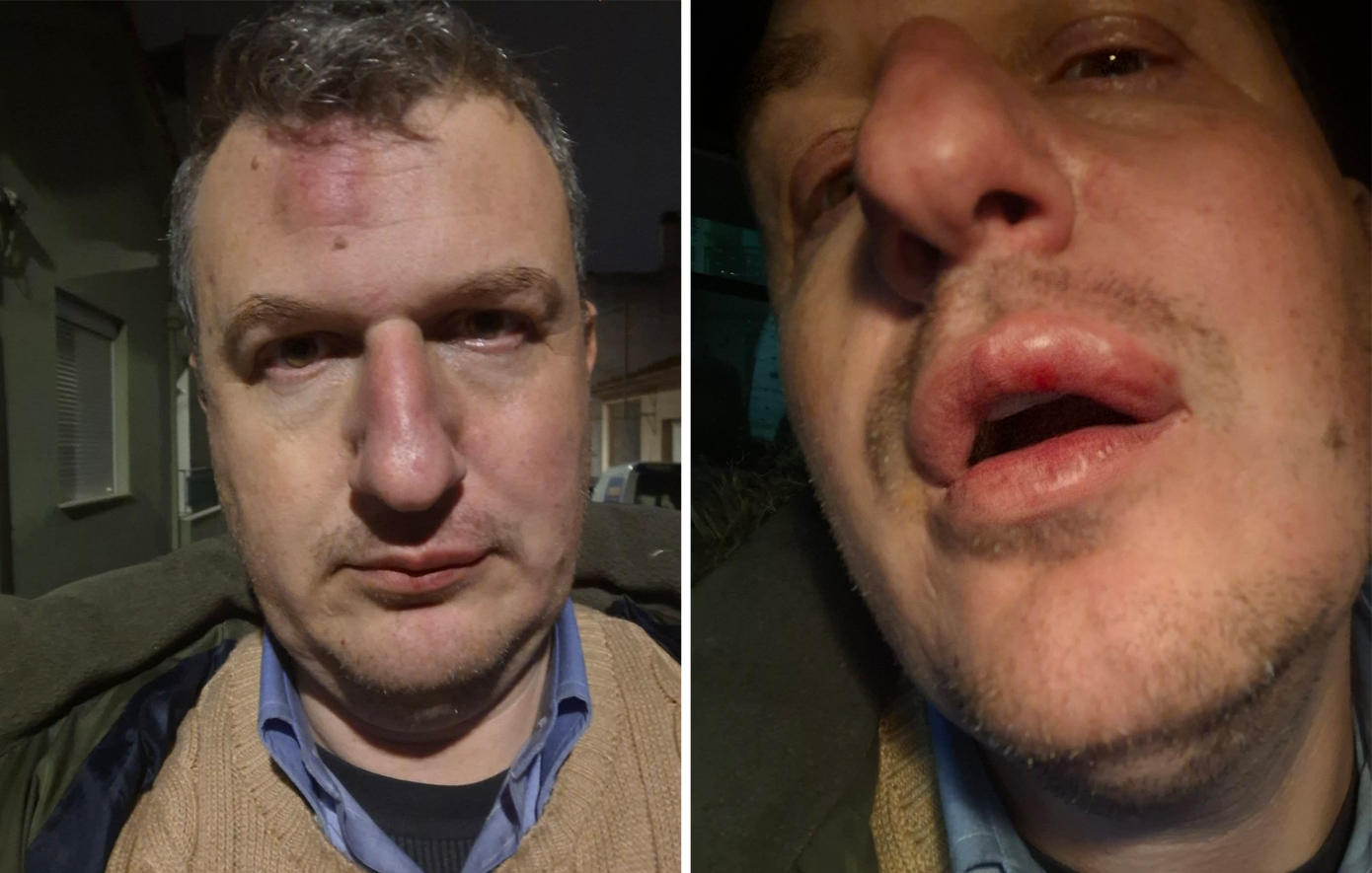 Καταιγισμός σχολίων στα social media μετά την άγρια επίθεση στον εκδότη της «Μαγνησίας» – «Συνεχίζω αμετακίνητος»