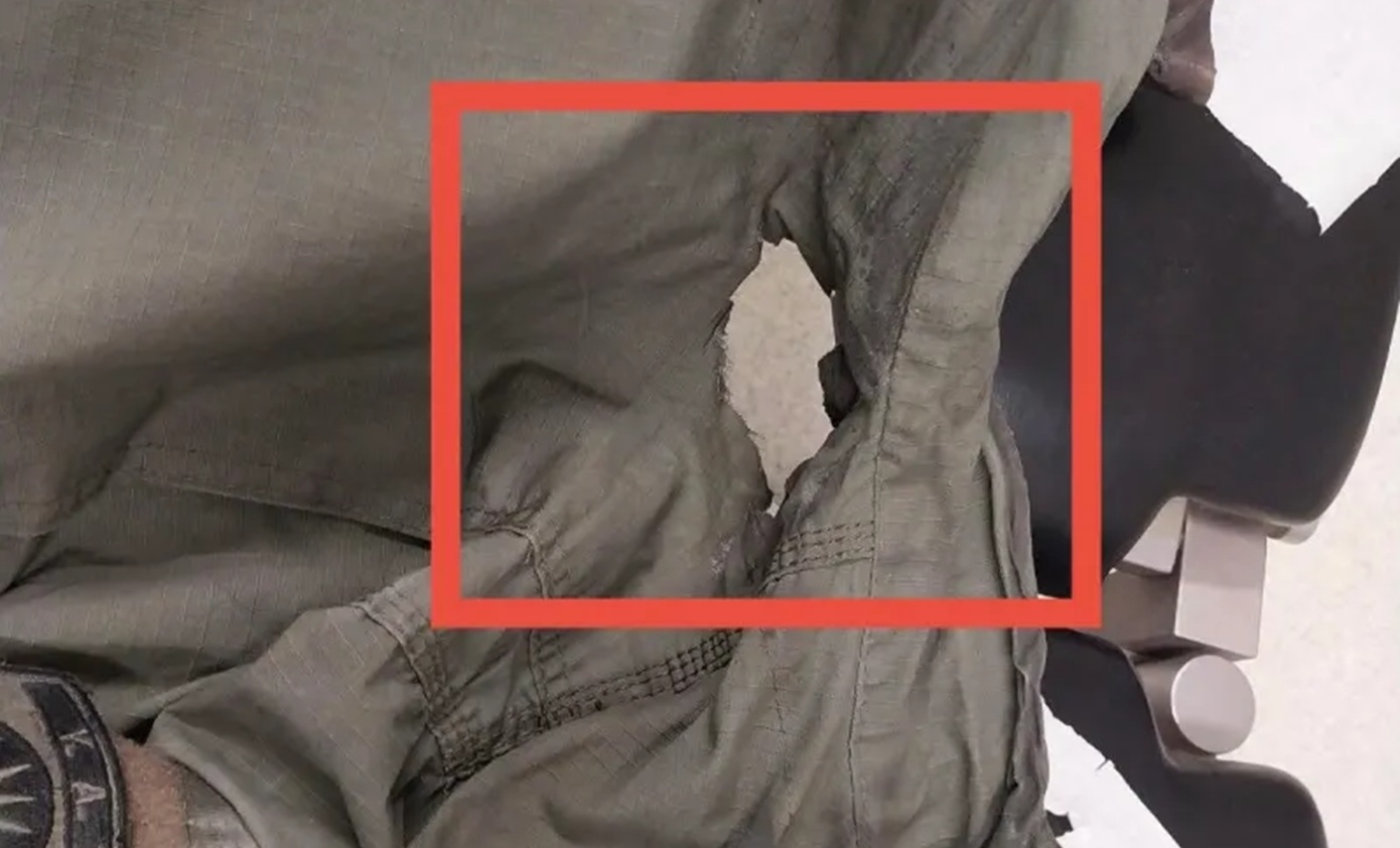 Συγκρούσεις στο ΑΠΘ: Τραυματισμός αστυνομικού από μολότοφ – «Η αστυνομία πρέπει να βελτιωθεί στην αντιμετώπιση αυτών των εγκληματιών»