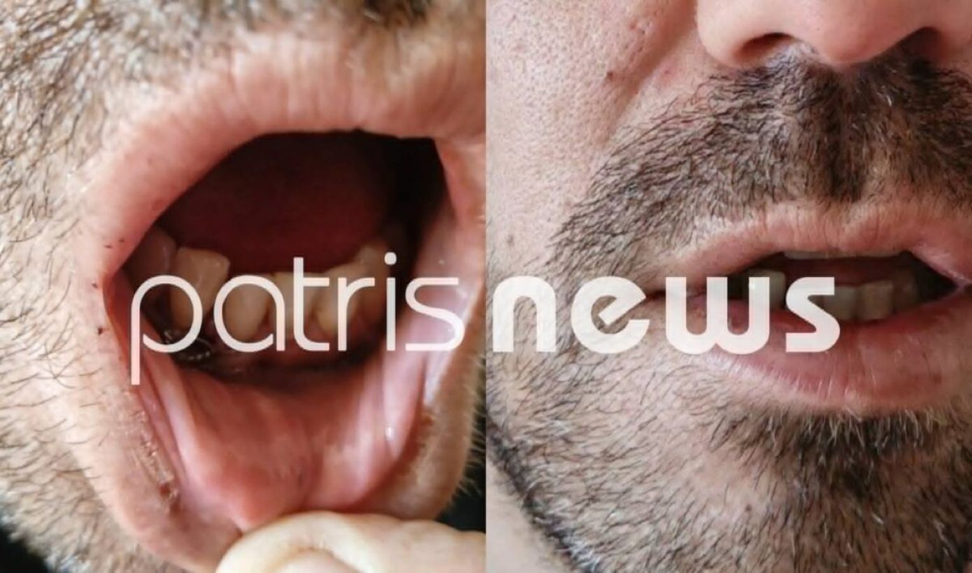 «Με χτυπούσαν για 15 λεπτά» – Σοκ προκαλεί η βίαιη επίθεση στα κρατητήρια της Αστυνομικής Διεύθυνσης Ηλείας