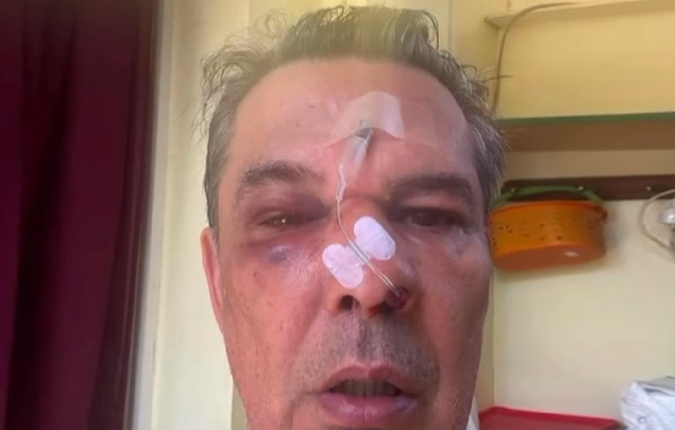 Ξυλοδαρμός σε ιατρείο στο Χαϊδάρι – Του μαύρισε το μάτι και τον έστειλε στο νοσοκομείο