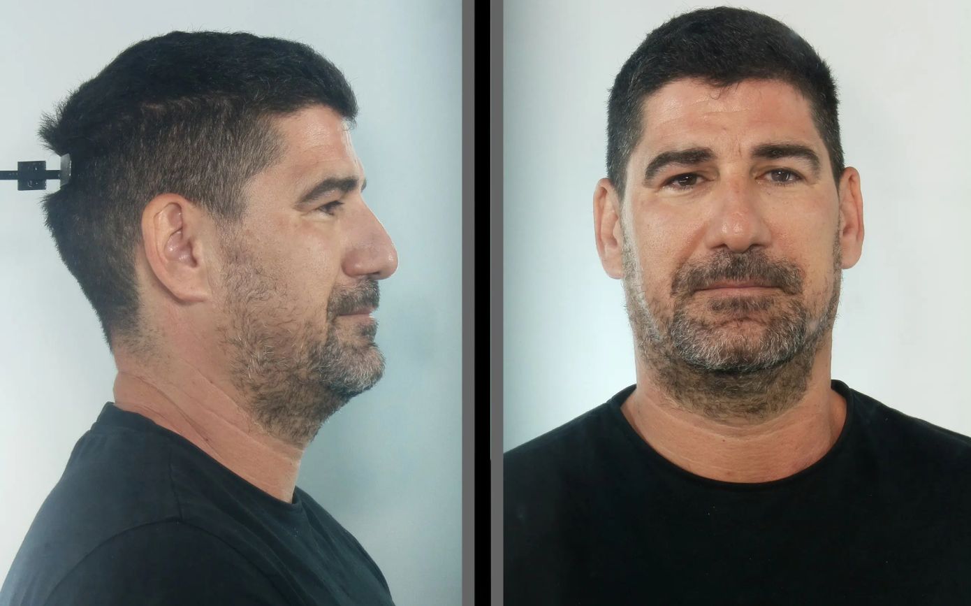 Κεφαλονιά: Στη δημοσιότητα τα στοιχεία του προπονητή που κατηγορείται για βιασμό ανηλίκου κατ’ εξακολούθηση