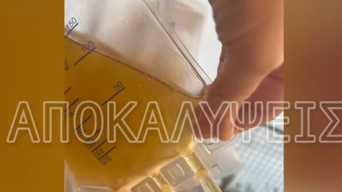 Γιατροί του Γιώργου Μαζωνάκη: Πρώην εργαζόμενη μιλά για δείγματα πλάσματος ασθενών στο μπαλκόνι σαν μπουγάδα