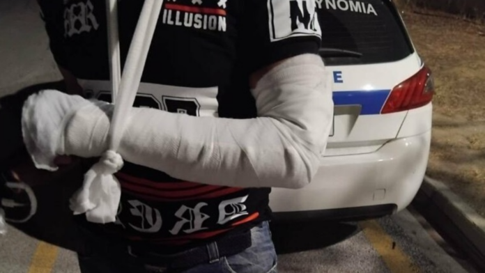 Ρομά έσπασε με σκουπόξυλο το χέρι ταξιτζή στον Βόλο επειδή του αρνήθηκε την κούρσα